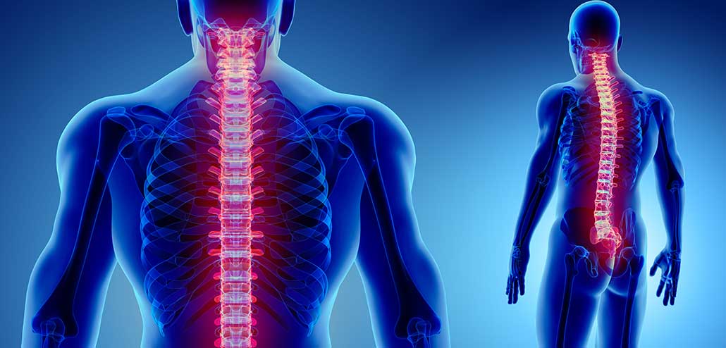 patologie della colonna vertebrale